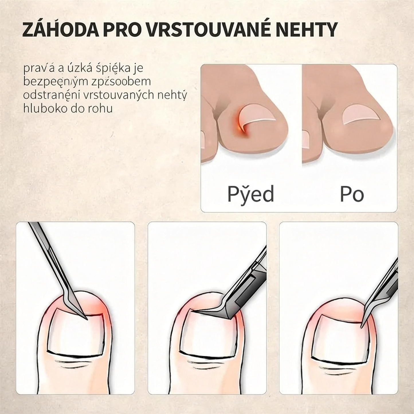 🎉 Exkluzivně pro členy –Speciálně navrženy pro seniory, nůžky na nehty proti stříkání , s lupou 🔍 pro přesné a bezpečné stříhání